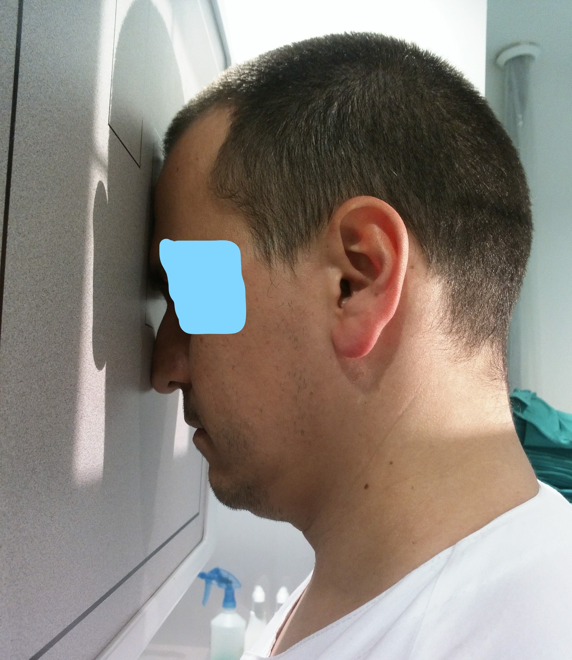 PA Skull Positioning